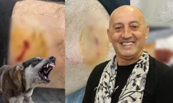 Gemlik Karacaali Muhtarı'na sokak köpeklerinden saldırı!