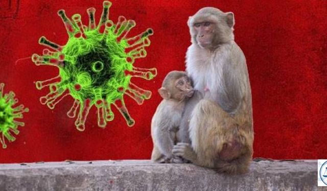 Maymun Çiçeği Virüsünde Son Durum Ne? Türkiye’yi Ne Bekliyor?