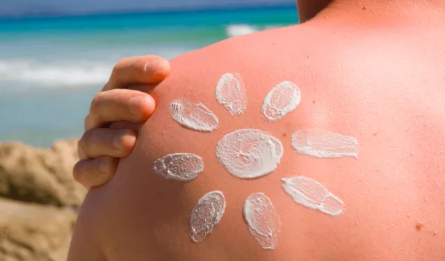 Güneş yanığına dikkat!